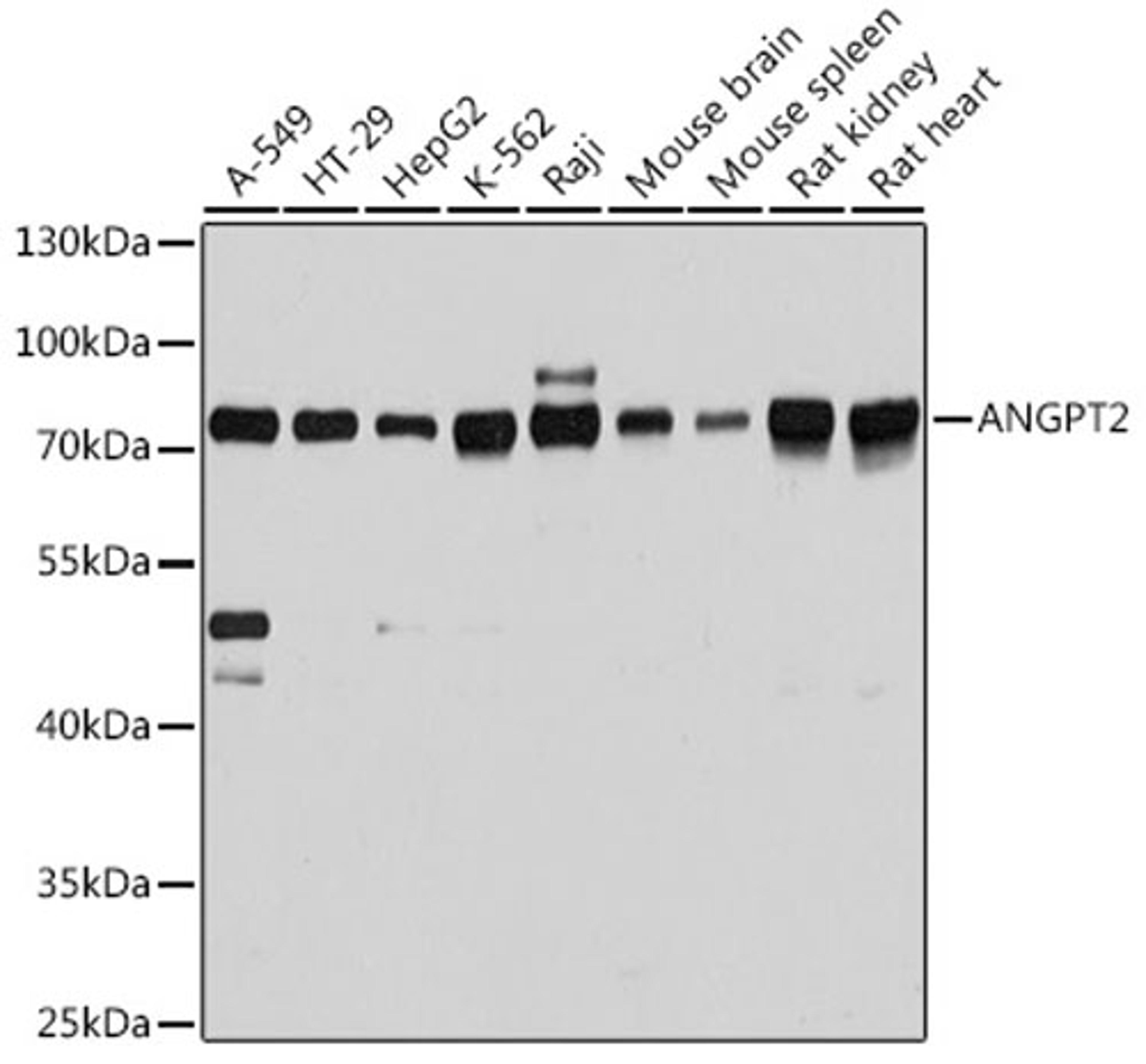 Western blot - ANGPT2 antibody (A0698)