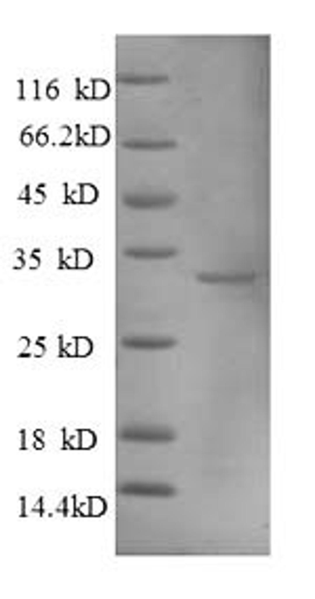 (Tris-Glycine gel) Discontinuous SDS-PAGE (reduced) with 5% enrichment gel and 15% separation gel.