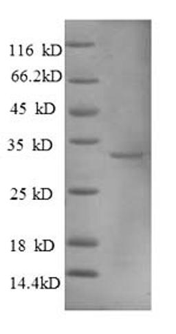 (Tris-Glycine gel) Discontinuous SDS-PAGE (reduced) with 5% enrichment gel and 15% separation gel.
