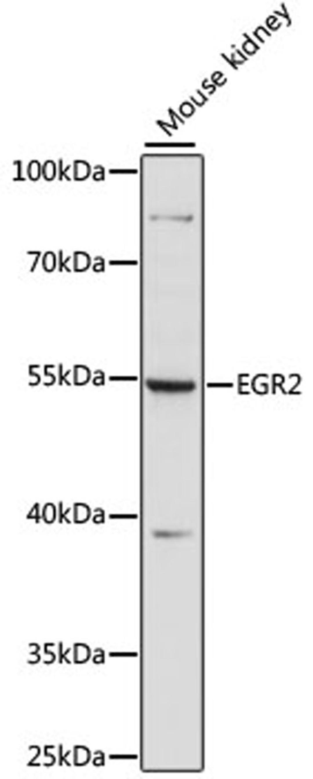 Western blot - EGR2 antibody (A15053)