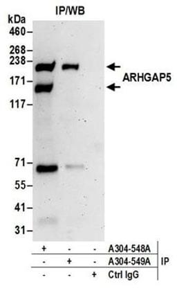 Detection of human ARHGAP5 by western blot of immunoprecipitates.