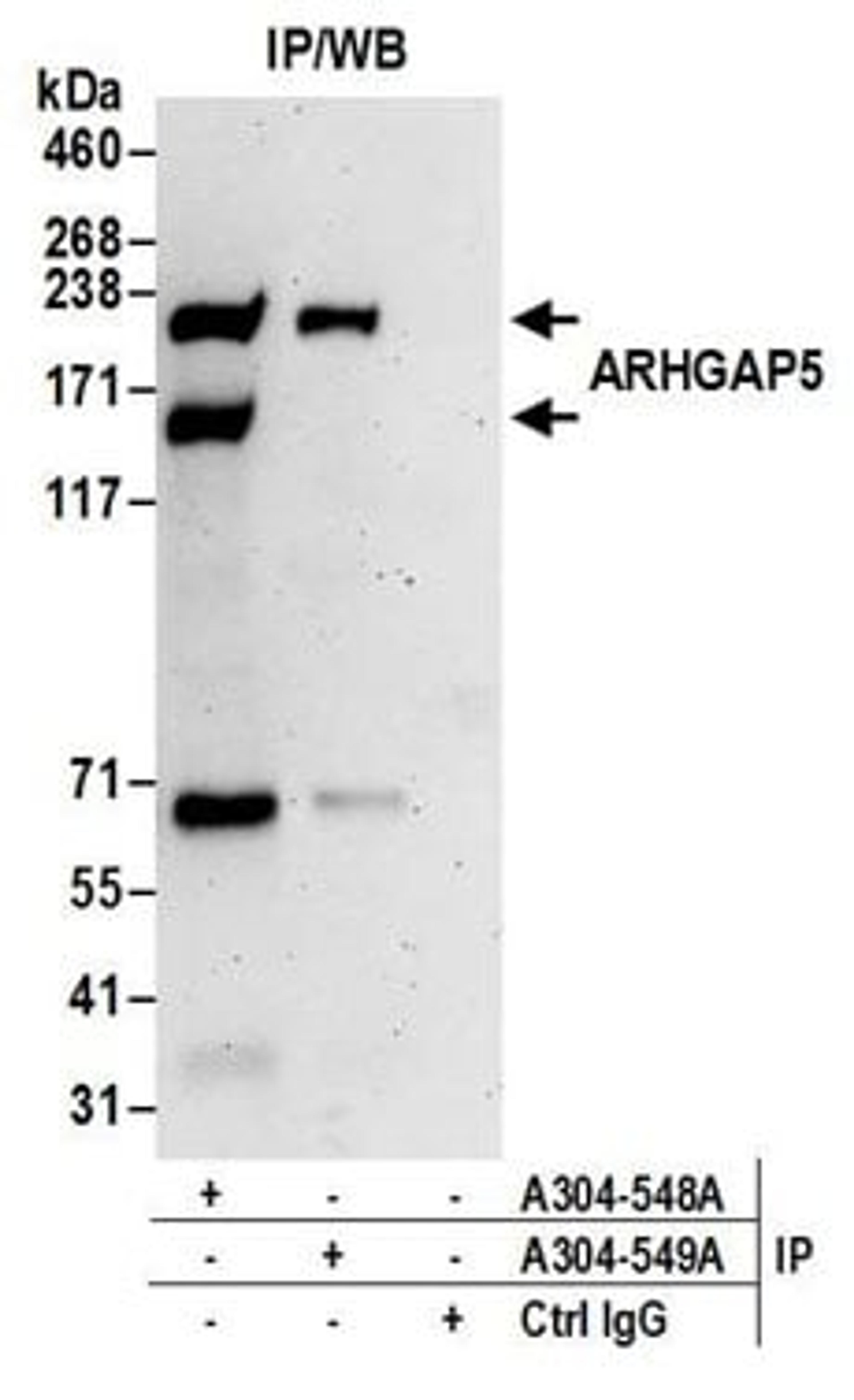 Detection of human ARHGAP5 by western blot of immunoprecipitates.