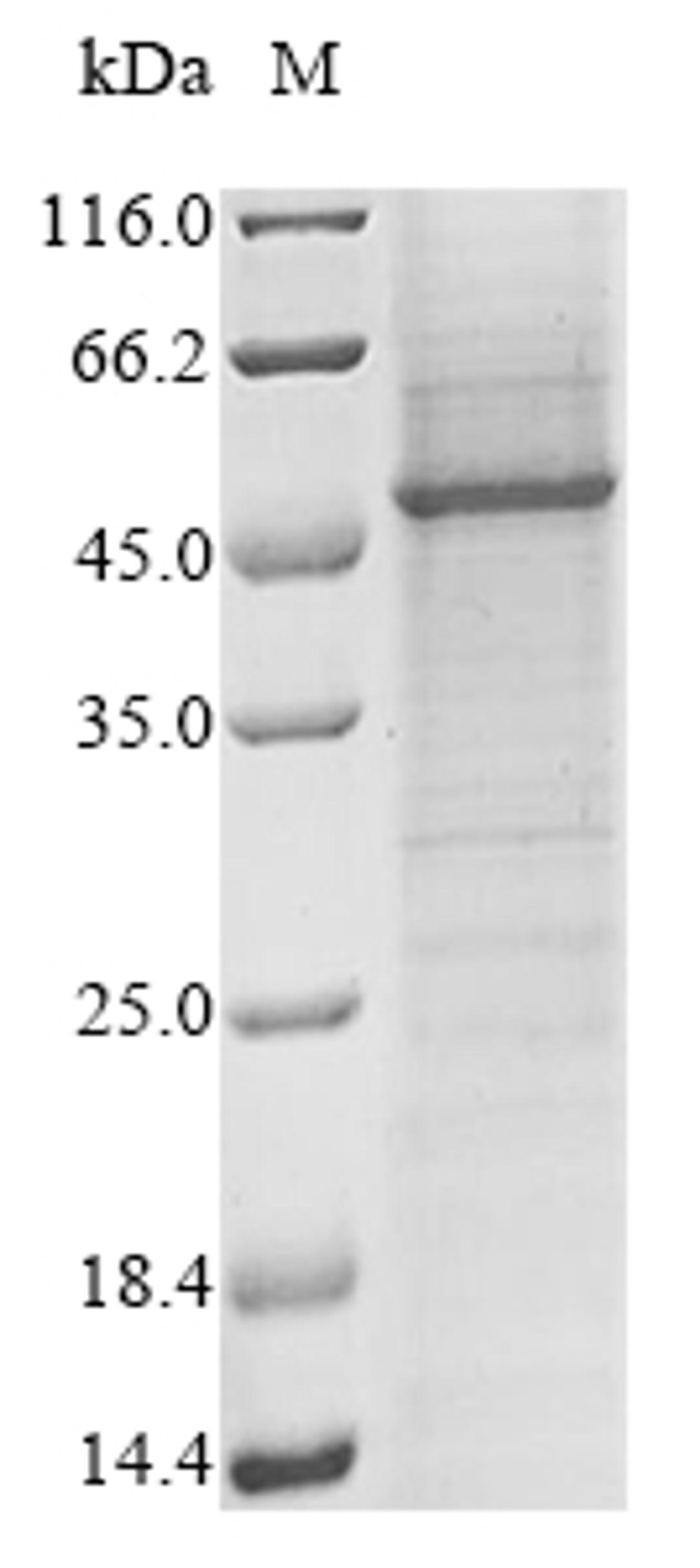 (Tris-Glycine gel) Discontinuous SDS-PAGE (reduced) with 5% enrichment gel and 15% separation gel.