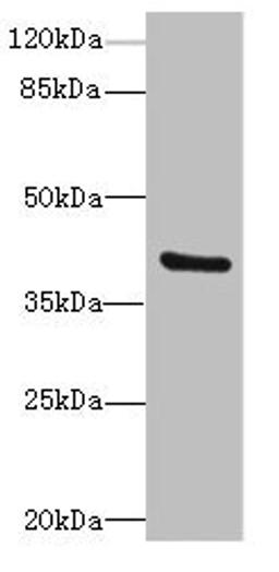 Western blot. All lanes: TMOD4antibody at 4.85ug/ml + Mouse muscle tissue. Secondary. Goat polyclonal to rabbit IgG at 1/10000 dilution. Predicted band size: 40, 32 kDa. Observed band size: 40 kDa. 