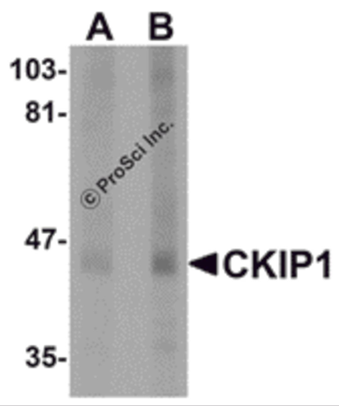 Western blot analysis of CKIP1 in human lung tissue lysate with CKIP1 antibody at (A) 1 and (B) 2 &#956;g/mL.