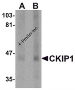 Western blot analysis of CKIP1 in human lung tissue lysate with CKIP1 antibody at (A) 1 and (B) 2 μg/mL.