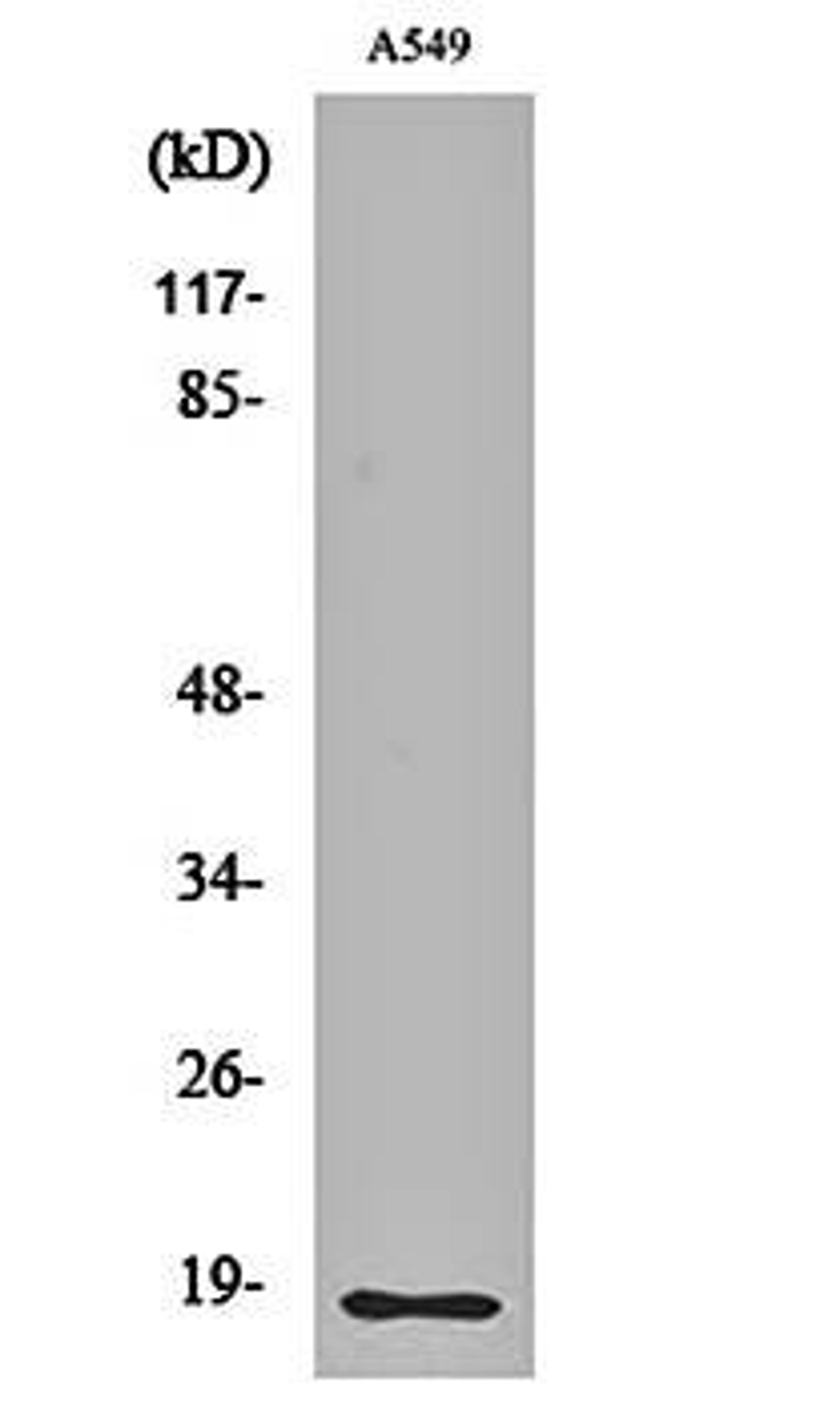 Western blot analysis of A549 cell lysates using Cleaved-MMP-1 22k (F100) antibody