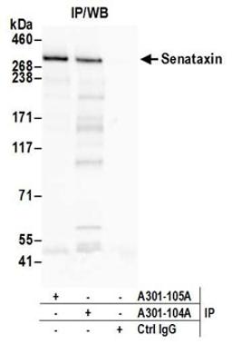 Detection of human Senataxin by western blot of immunoprecipitates.