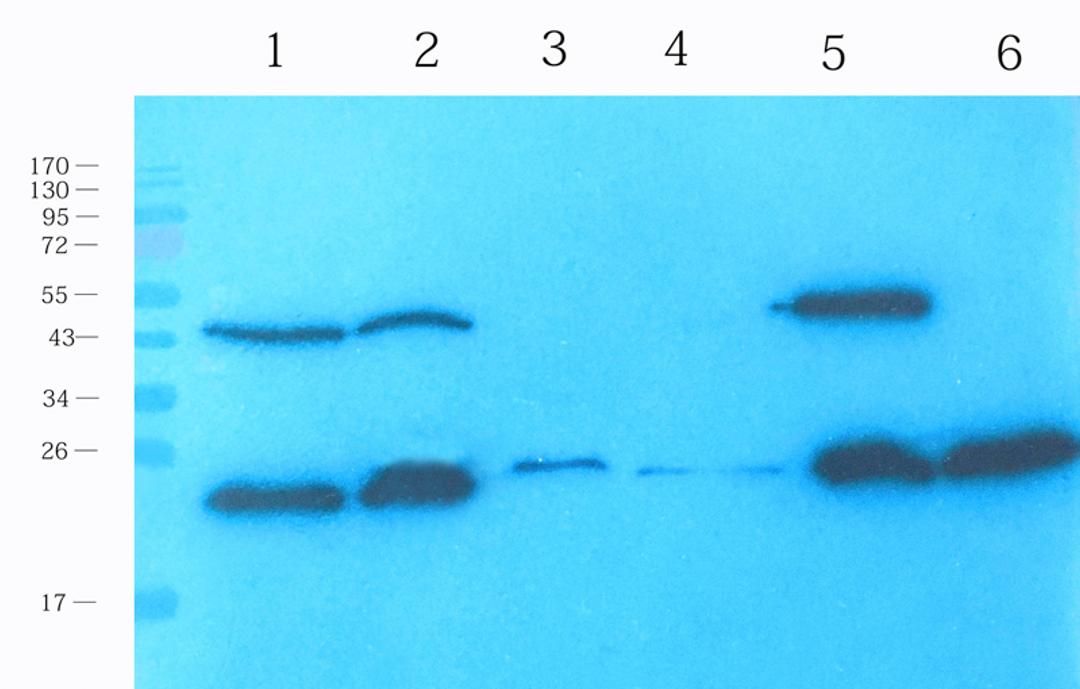 Western blot analysis of rat small intestines (lane 1), rat pancreas (lane 2), mouse spinal cord (lane 3), rat colon (lane 4), rat testis (lane 5), mouse stomach (lane 6) using Reg3 gamma antibody (1 ug/ml)