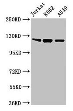 Western Blot. Positive WB detected in: Jurkat whole cell lysate, K562 whole cell lysate, A549 whole cell lysate. All lanes: Tlr7 antibody at 2µg/ml. Secondary. Goat polyclonal to rabbit IgG at 1/50000 dilution. Predicted band size: 122 kDa. Observed band size: 122 kDa
