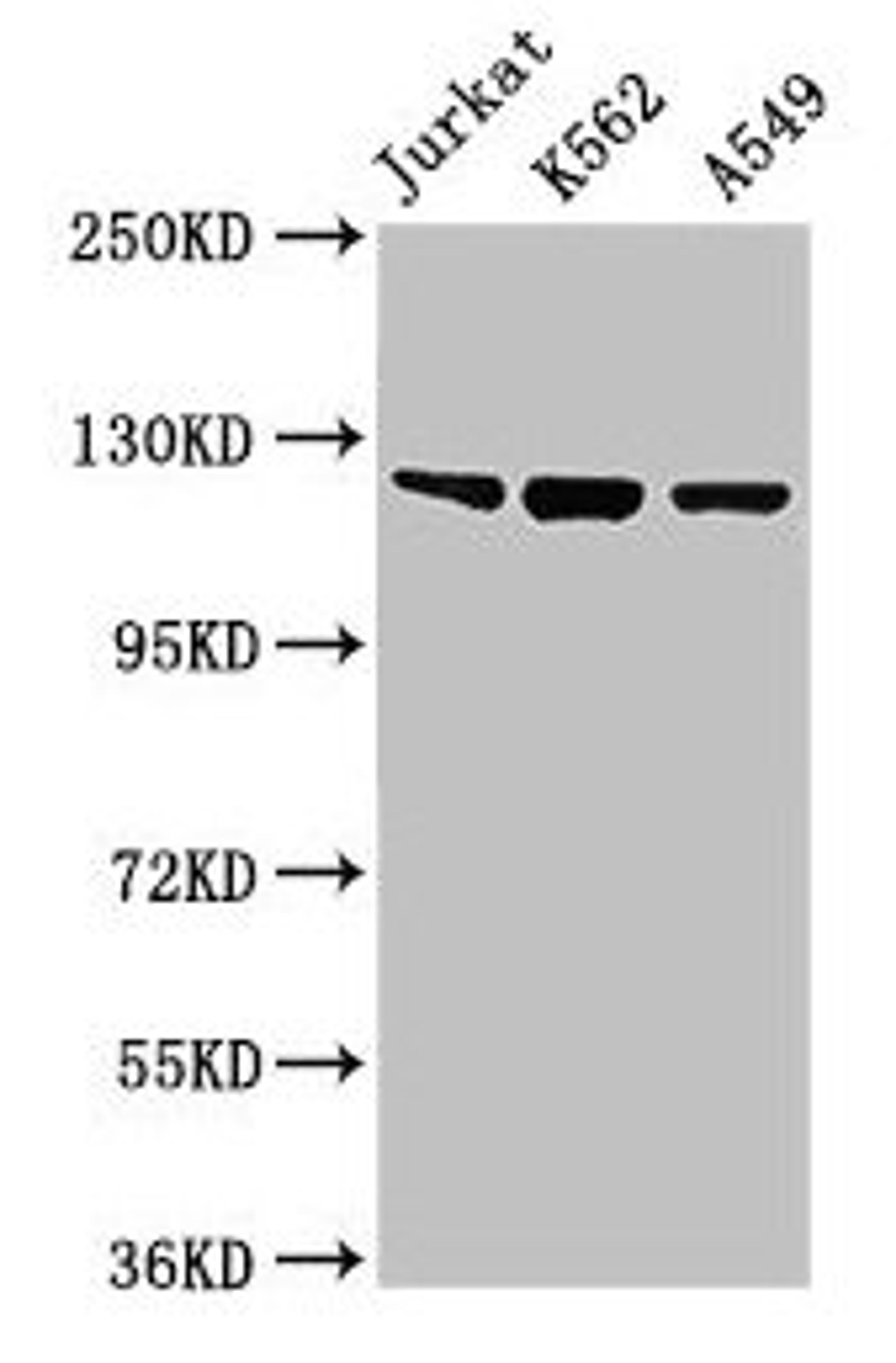 Western Blot. Positive WB detected in: Jurkat whole cell lysate, K562 whole cell lysate, A549 whole cell lysate. All lanes: Tlr7 antibody at 2µg/ml. Secondary. Goat polyclonal to rabbit IgG at 1/50000 dilution. Predicted band size: 122 kDa. Observed band size: 122 kDa