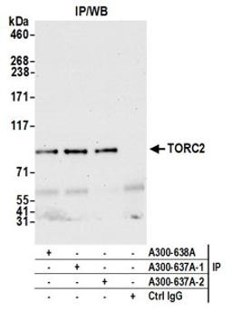 Detection of human TORC2 by western blot of immunoprecipitates.