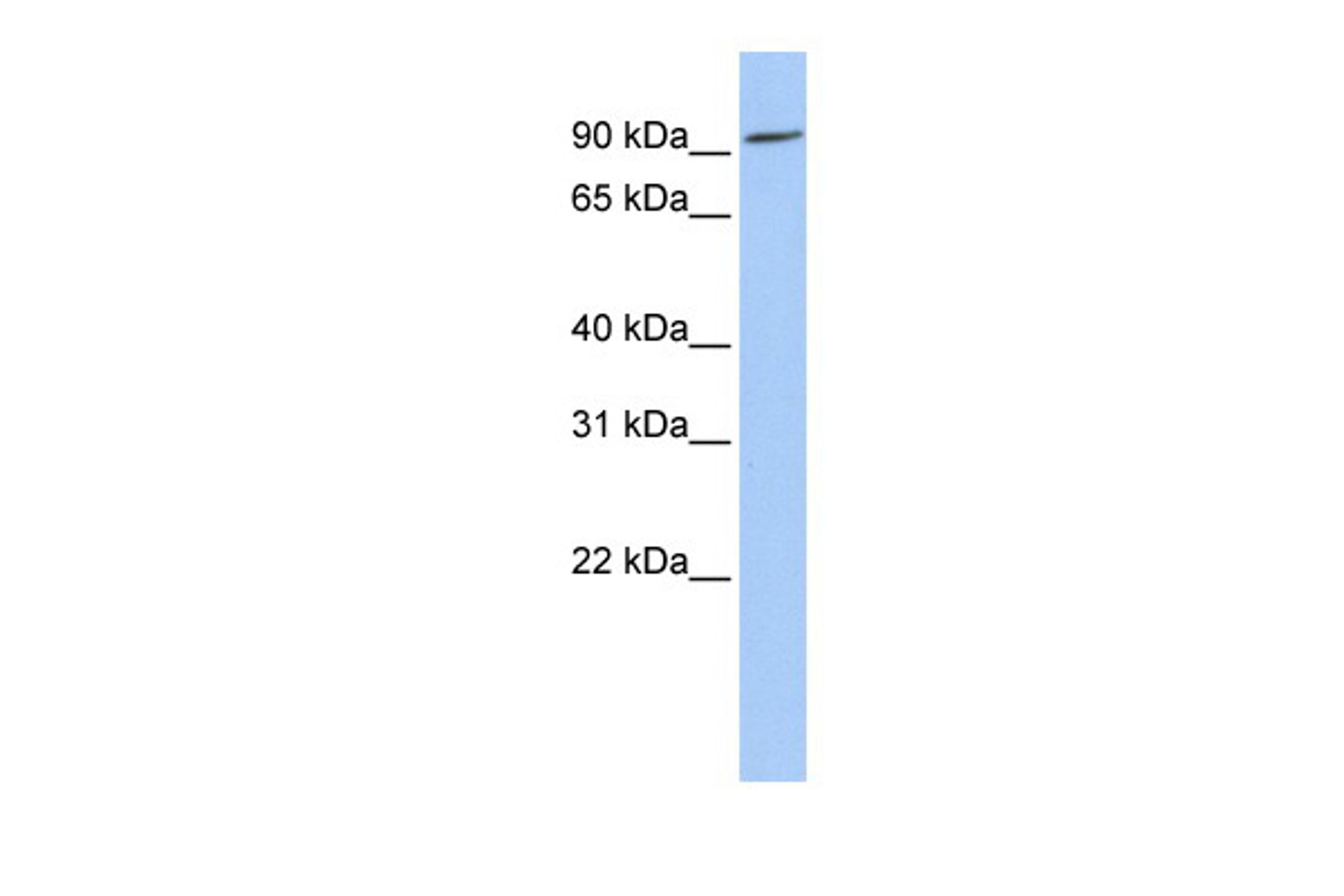 Antibody used in WB on Human Placenta at 0.2-1 ug/ml.