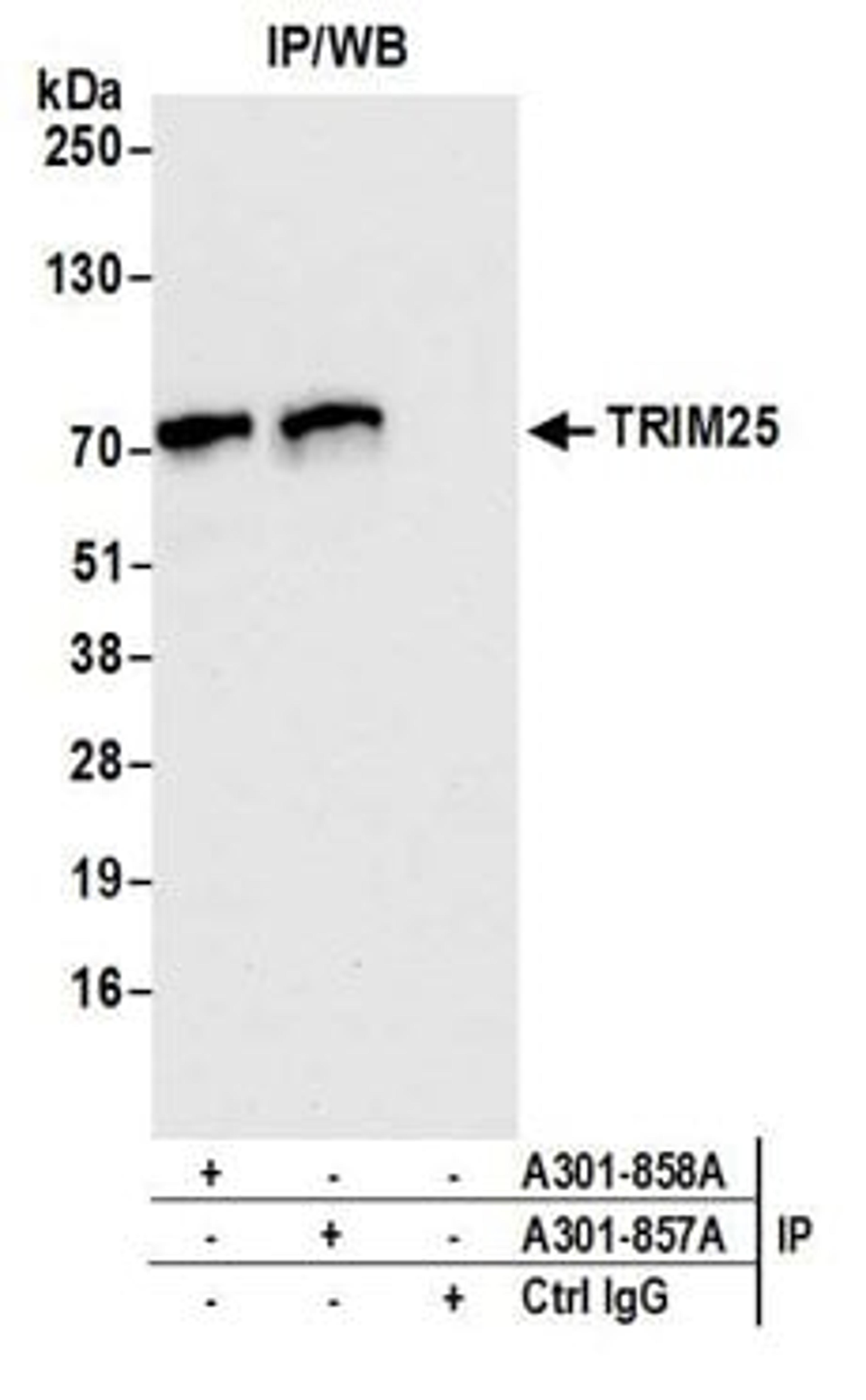 Detection of human TRIM25 by western blot of immunoprecipitates.