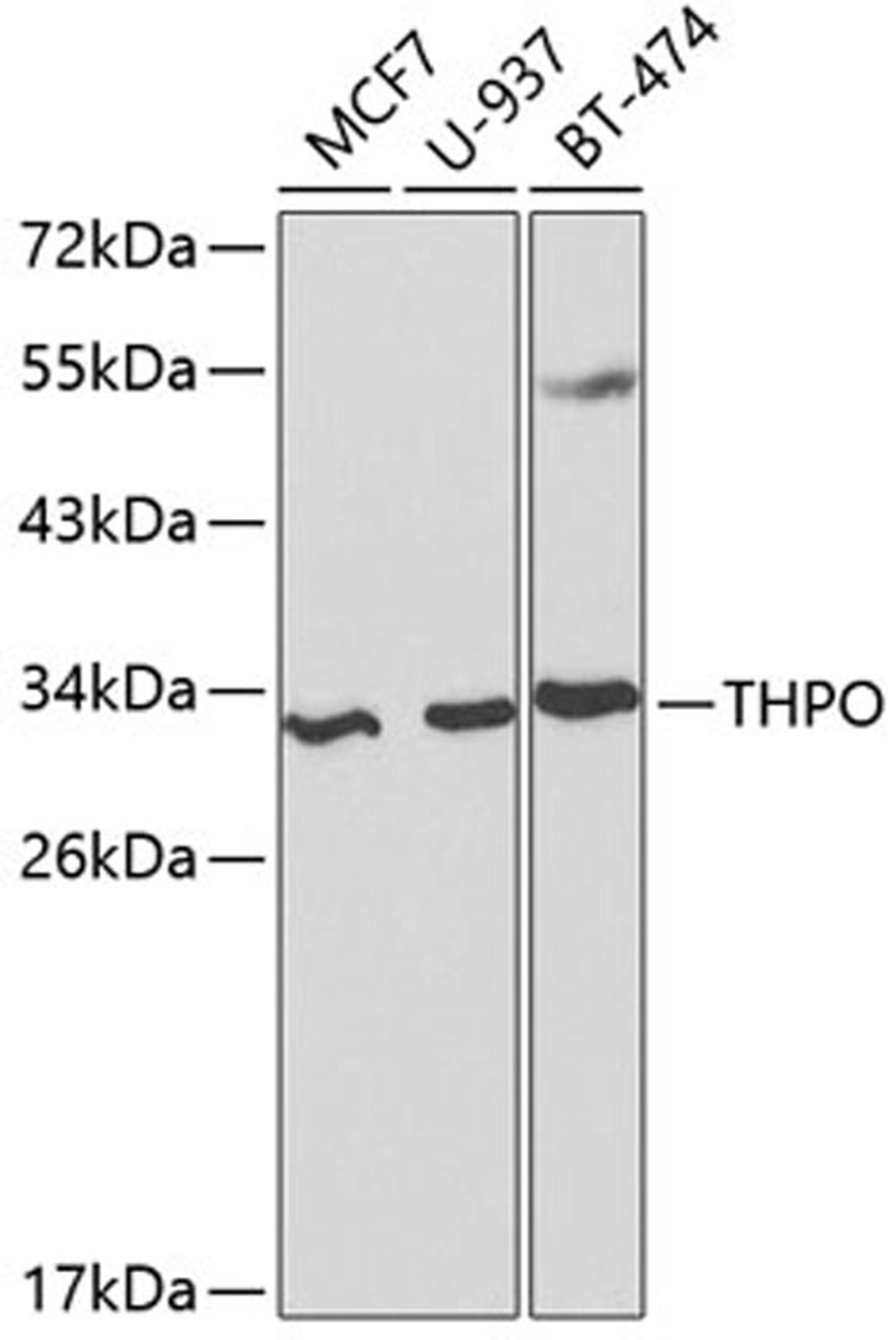 Western blot - THPO antibody (A1825)