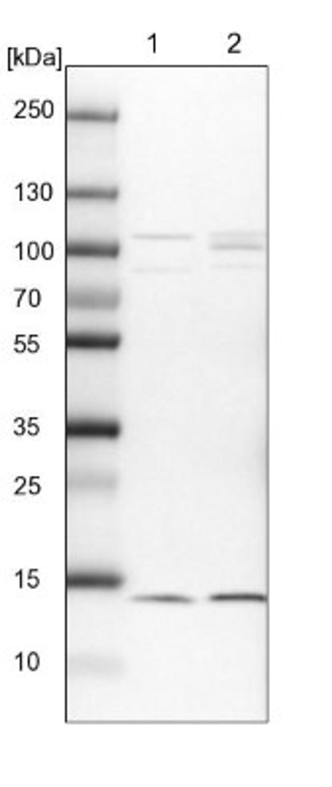 Western Blot: HINT1 Antibody [NBP1-83257] - Lane 1: NIH-3T3 cell lysate (Mouse embryonic fibroblast cells)<br/>Lane 2: NBT-II cell lysate (Rat Wistar bladder tumour cells)