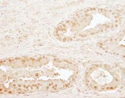 Detection of human CPSF73 by immunohistochemistry.