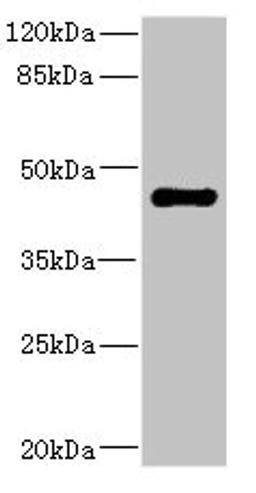 Western blot. All lanes: STRADA antibody IgG at 1.98ug/ml + Rat heart tissue. Secondary. Goat polyclonal to rabbit IgG at 1/10000 dilution. Predicted band size: 49, 39, 44, 34, 42, 35 kDa. Observed band size: 49 kDa. 