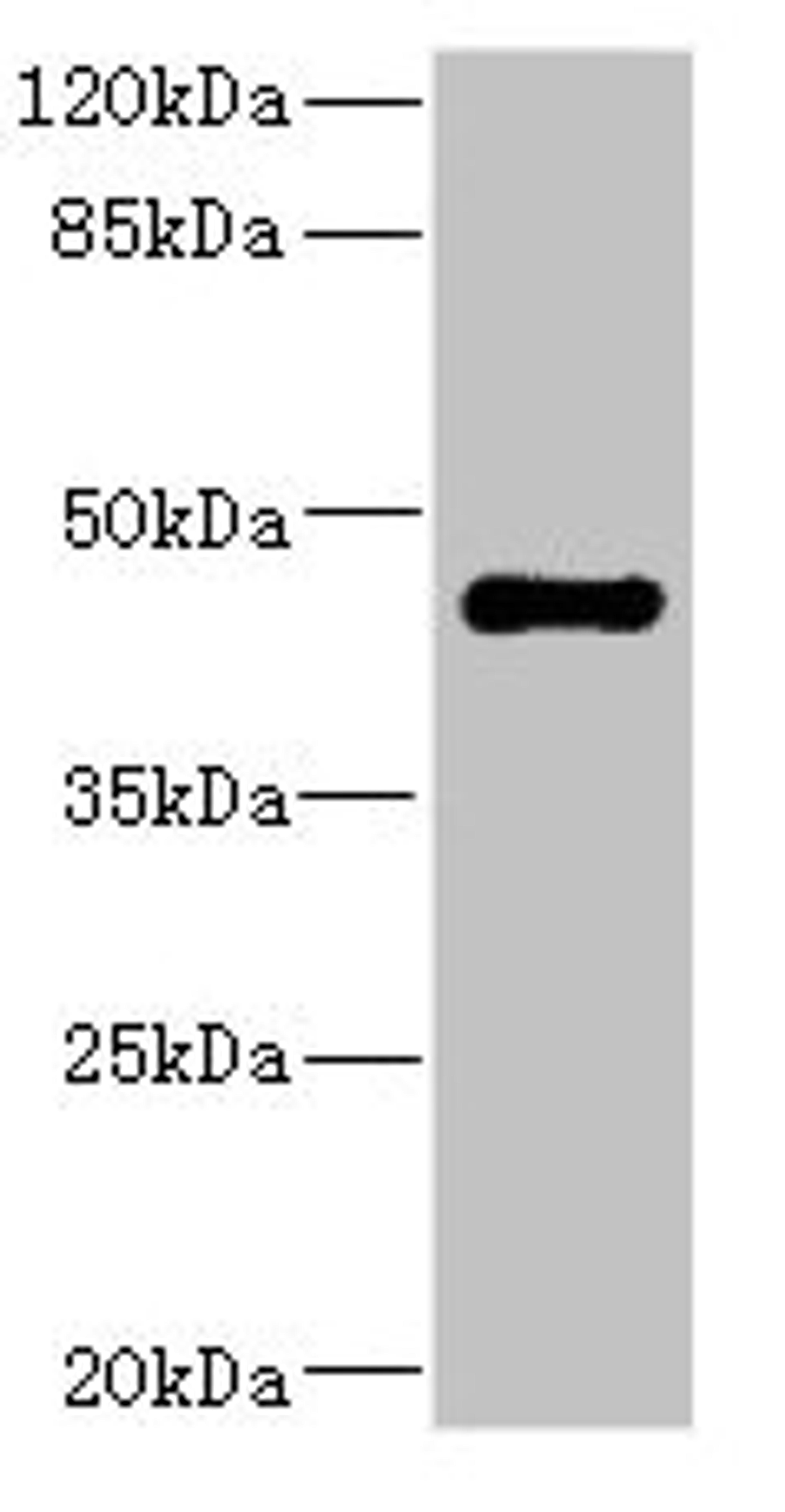 Western blot. All lanes: STRADA antibody IgG at 1.98ug/ml + Rat heart tissue. Secondary. Goat polyclonal to rabbit IgG at 1/10000 dilution. Predicted band size: 49, 39, 44, 34, 42, 35 kDa. Observed band size: 49 kDa. 