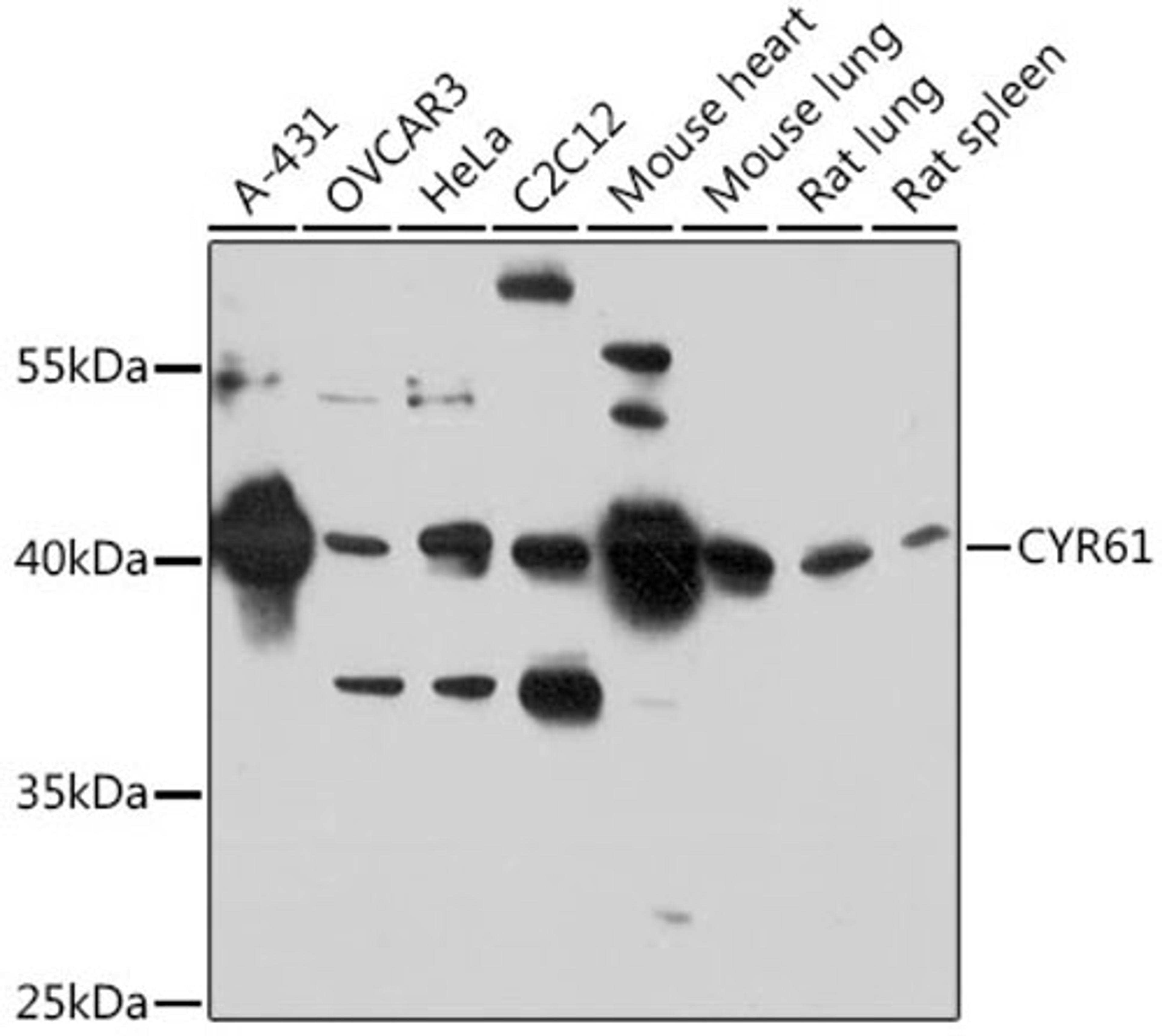 Western blot - CYR61 antibody (A1111)