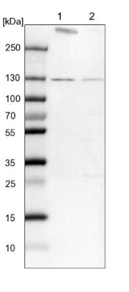 Western Blot: RNF40 Antibody [NBP1-88356] - Lane 1: NIH-3T3 cell lysate (Mouse embryonic fibroblast cells)<br/>Lane 2: NBT-II cell lysate (Rat Wistar bladder tumour cells)