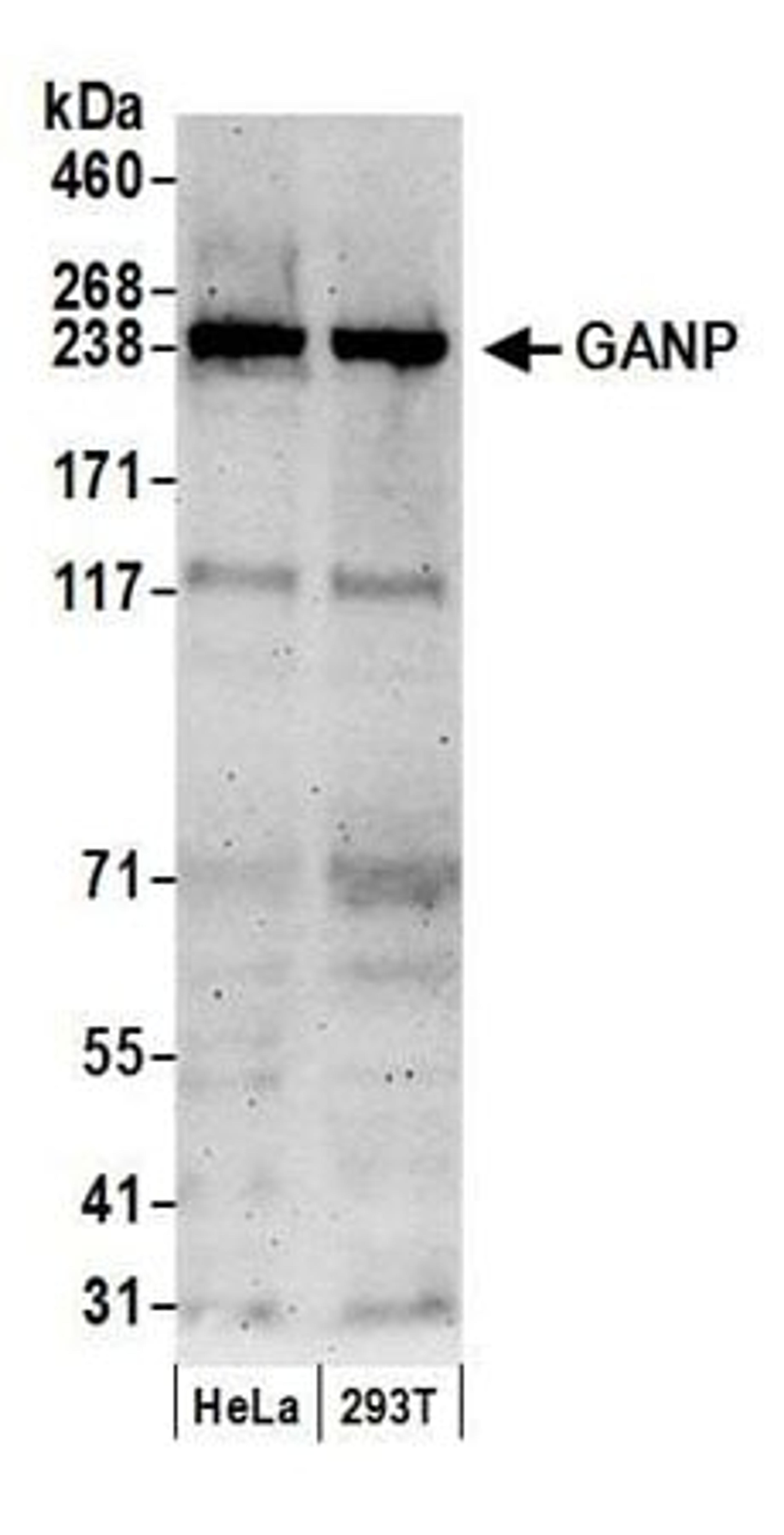 Detection of human GANP by western blot.