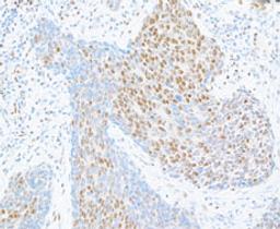 Detection of human CTCF by immunohistochemistry.