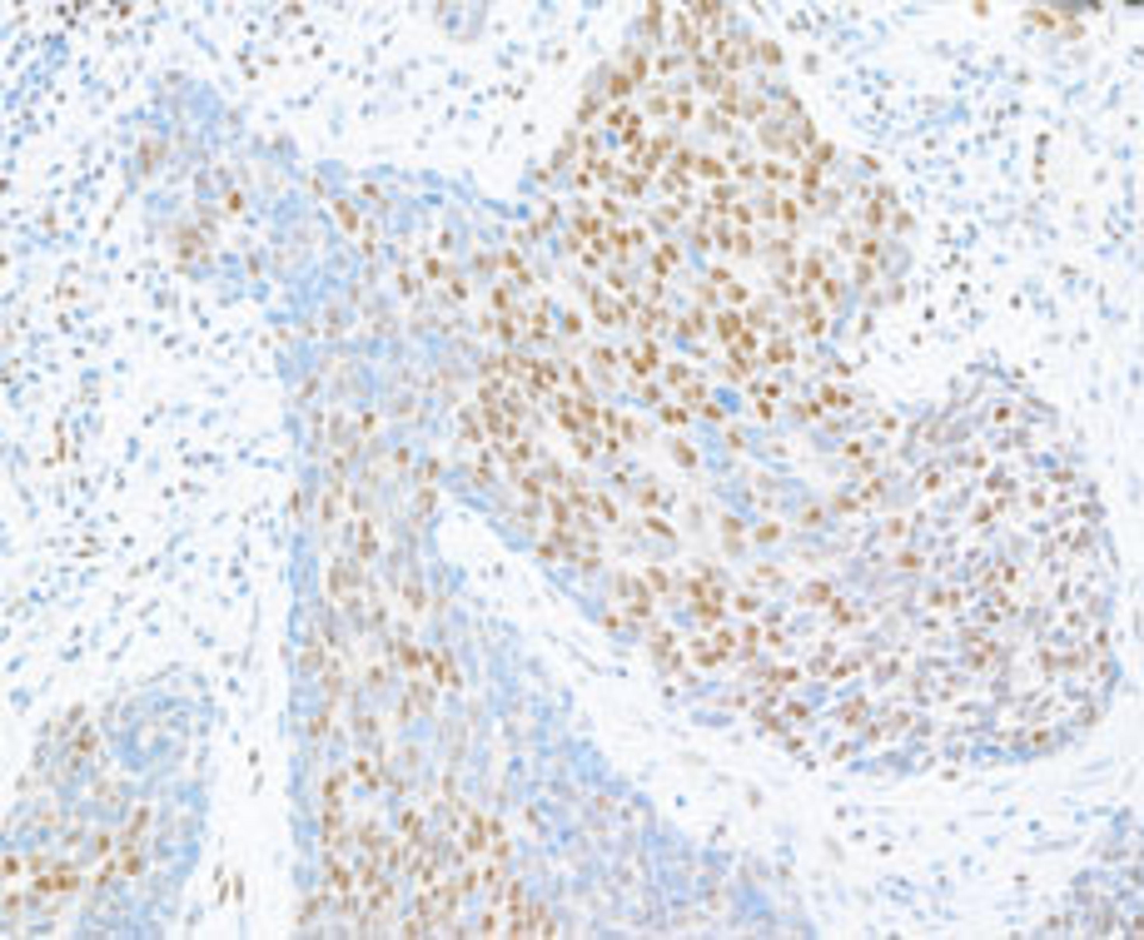 Detection of human CTCF by immunohistochemistry.