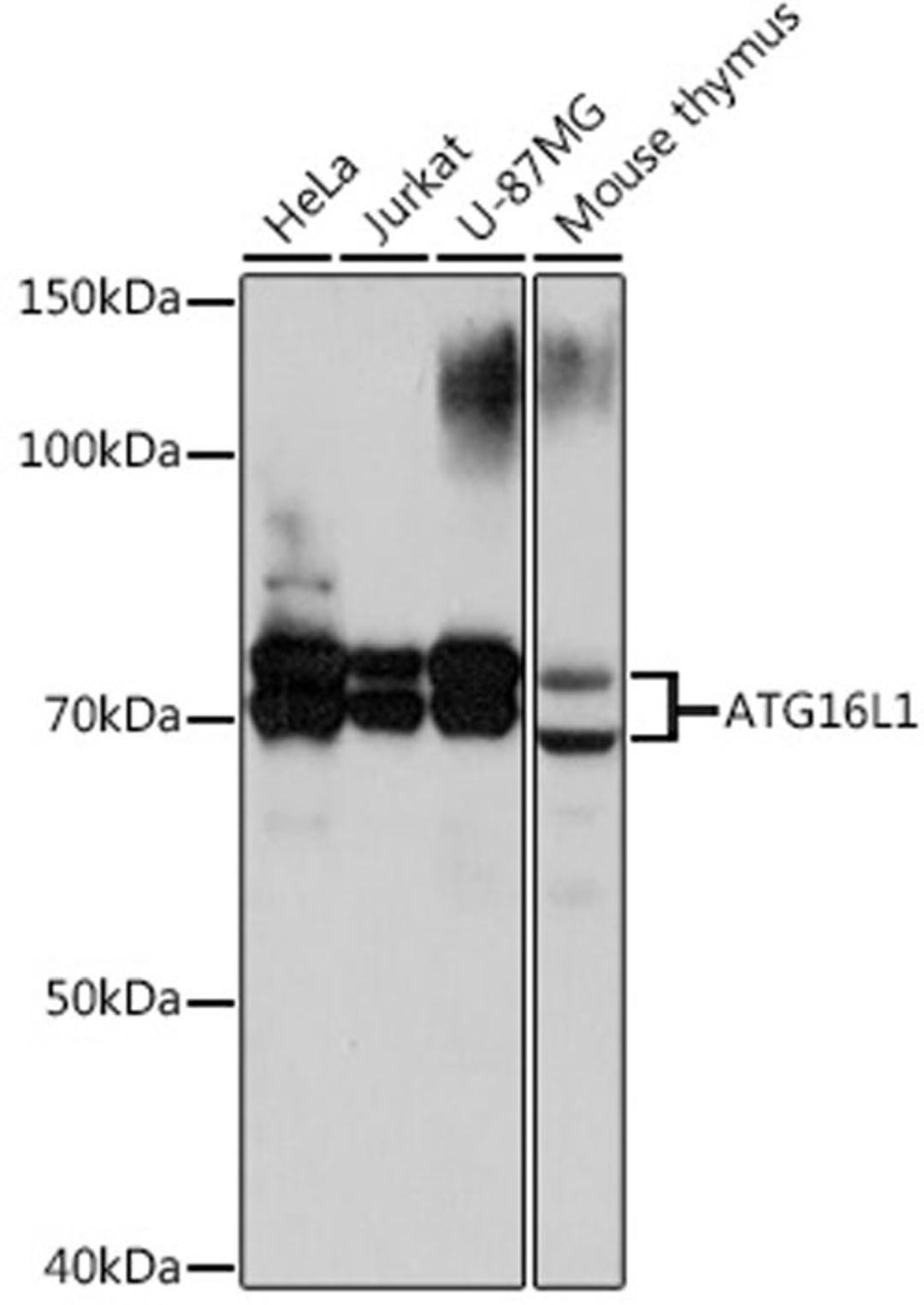 Western blot - ATG16L1 Rabbit mAb (A3637)