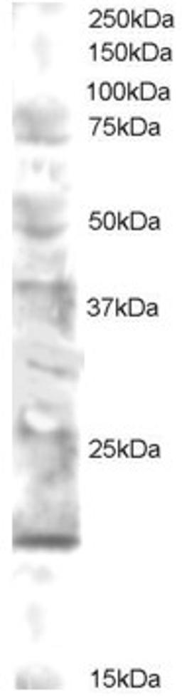 45-892 staining (0.5ug/ml) of human brain lysate (RIPA buffer, 30ug total protein per lane). Primary incubated for 12 hour. Detected by western blot using chemiluminescence.