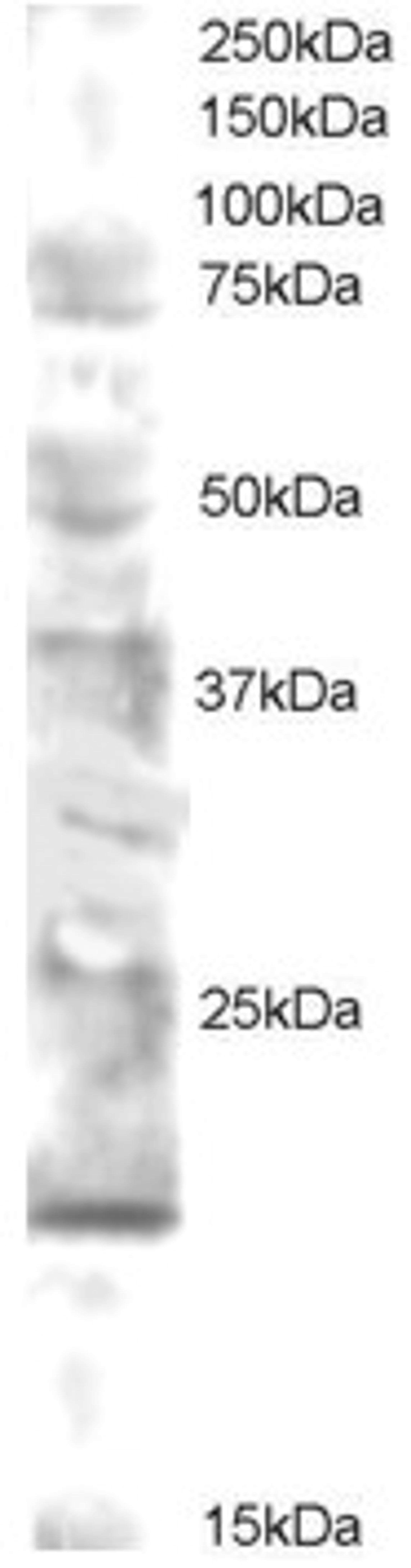 45-892 staining (0.5ug/ml) of human brain lysate (RIPA buffer, 30ug total protein per lane). Primary incubated for 12 hour. Detected by western blot using chemiluminescence.