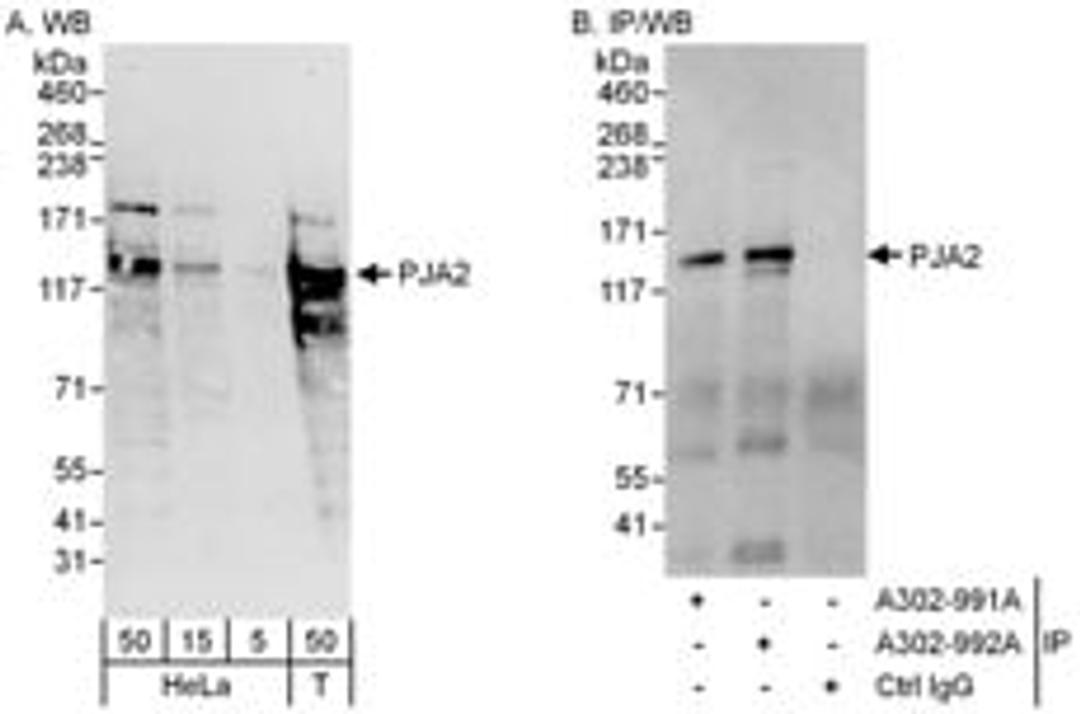 Detection of human PJA2 by western blot and immunoprecipitation.