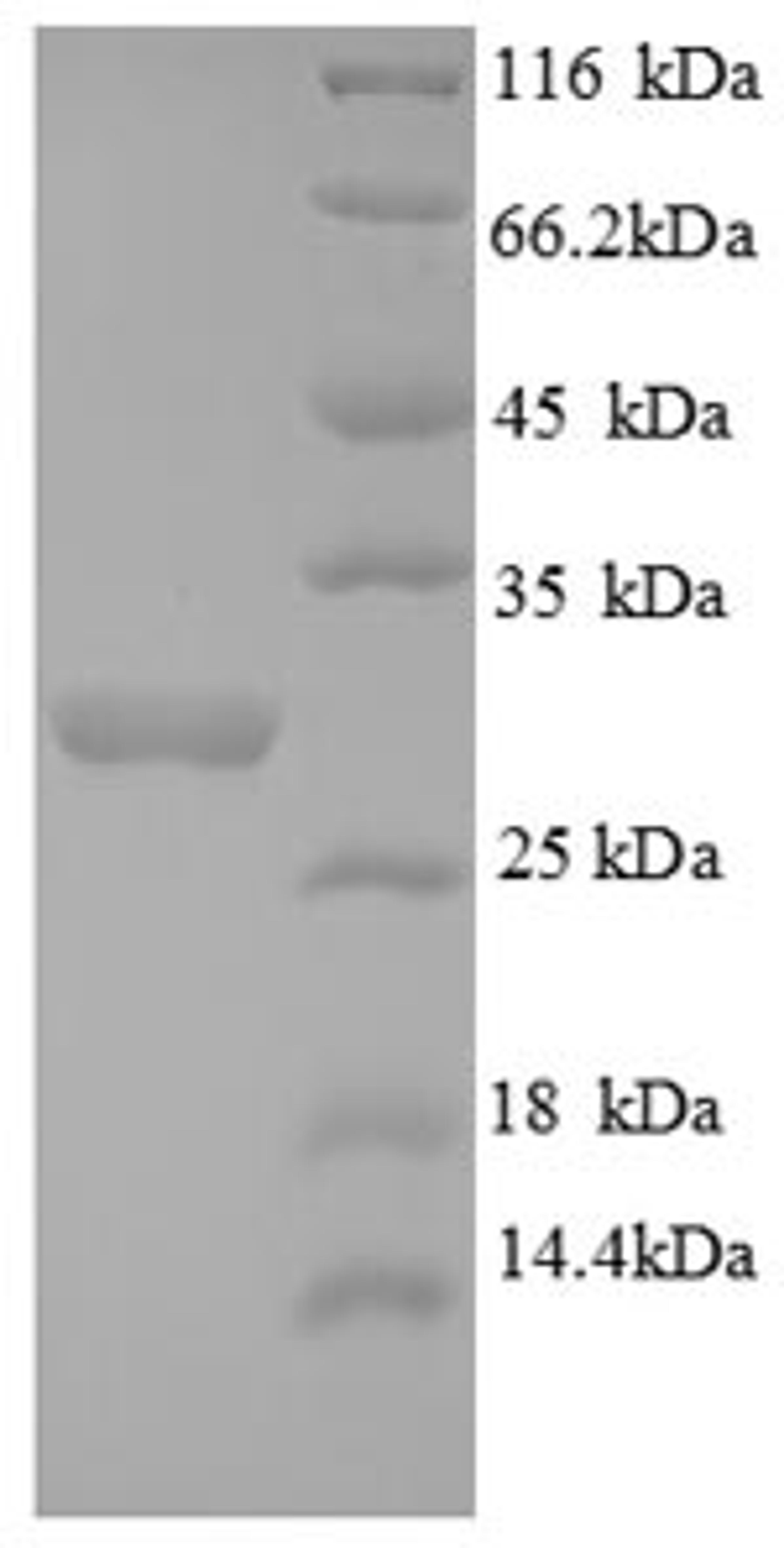 (Tris-Glycine gel) Discontinuous SDS-PAGE (reduced) with 5% enrichment gel and 15% separation gel.