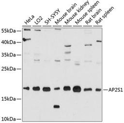 Western blot - AP2S1 antibody (A12270)