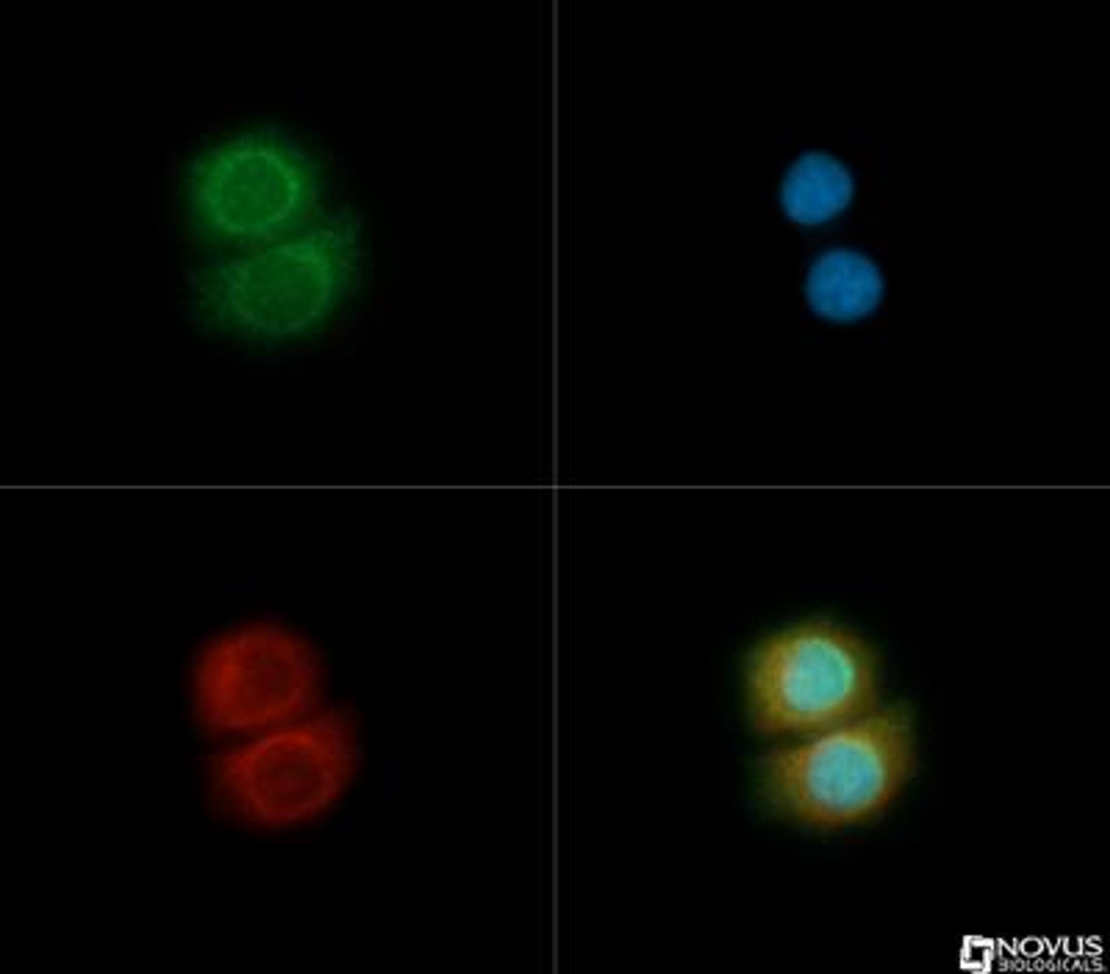 Immunocytochemistry/Immunofluorescence: TOM70 Antibody [NB110-58347] - TOM70 antibody was tested in MCF7 cells with Dylight 488 (green). Nuclei and alpha-tubulin were counterstained with DAPI (blue) and Dylight 550 (red).