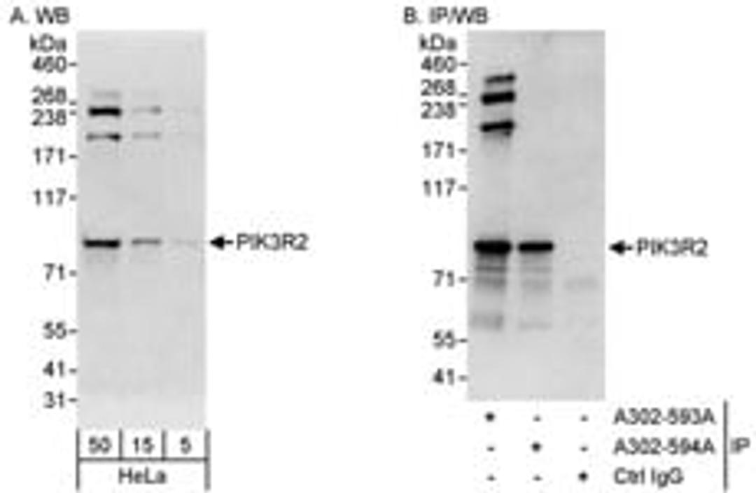 Detection of human PIK3R2 by western blot and immunoprecipitation.