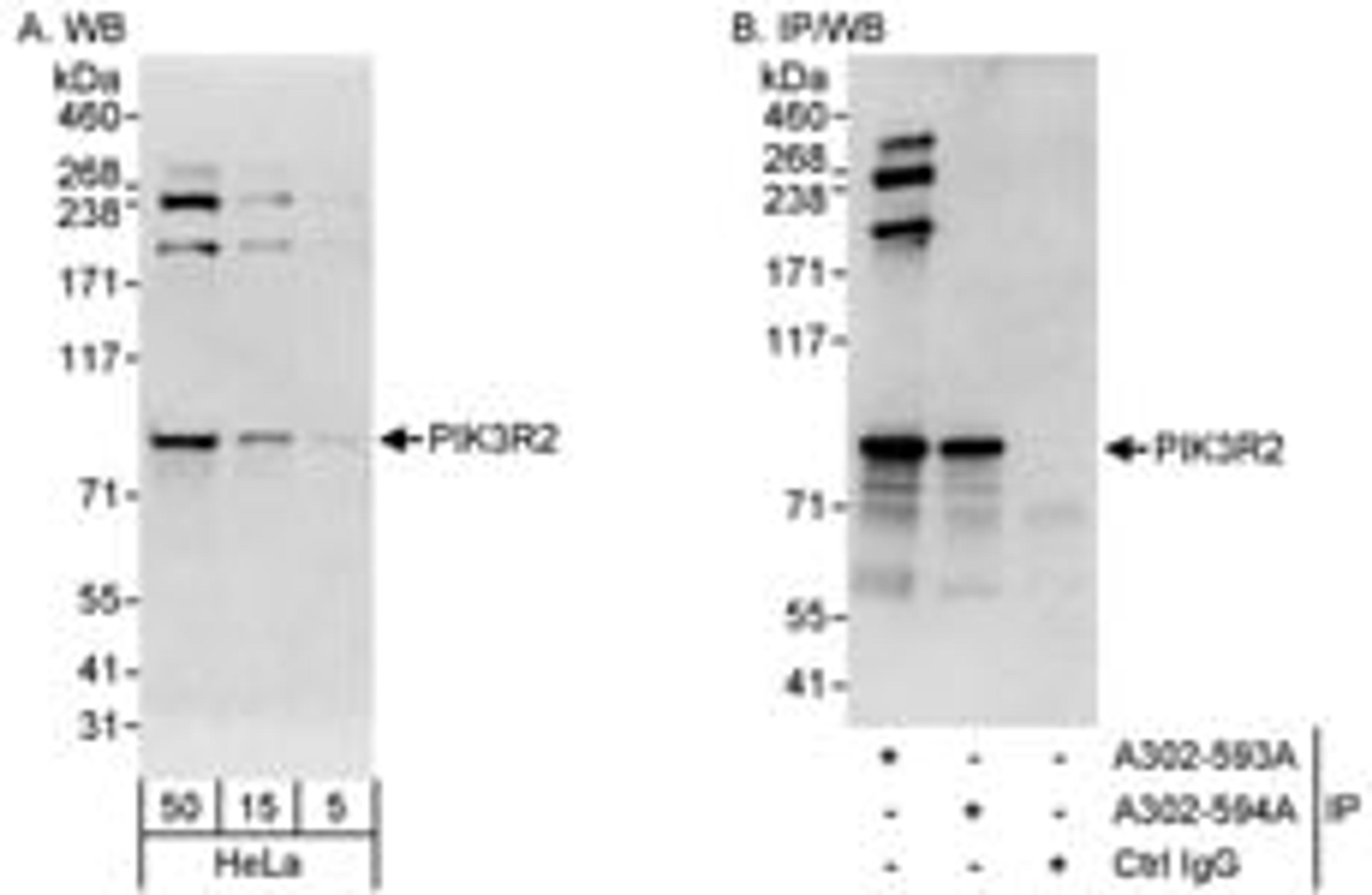 Detection of human PIK3R2 by western blot and immunoprecipitation.