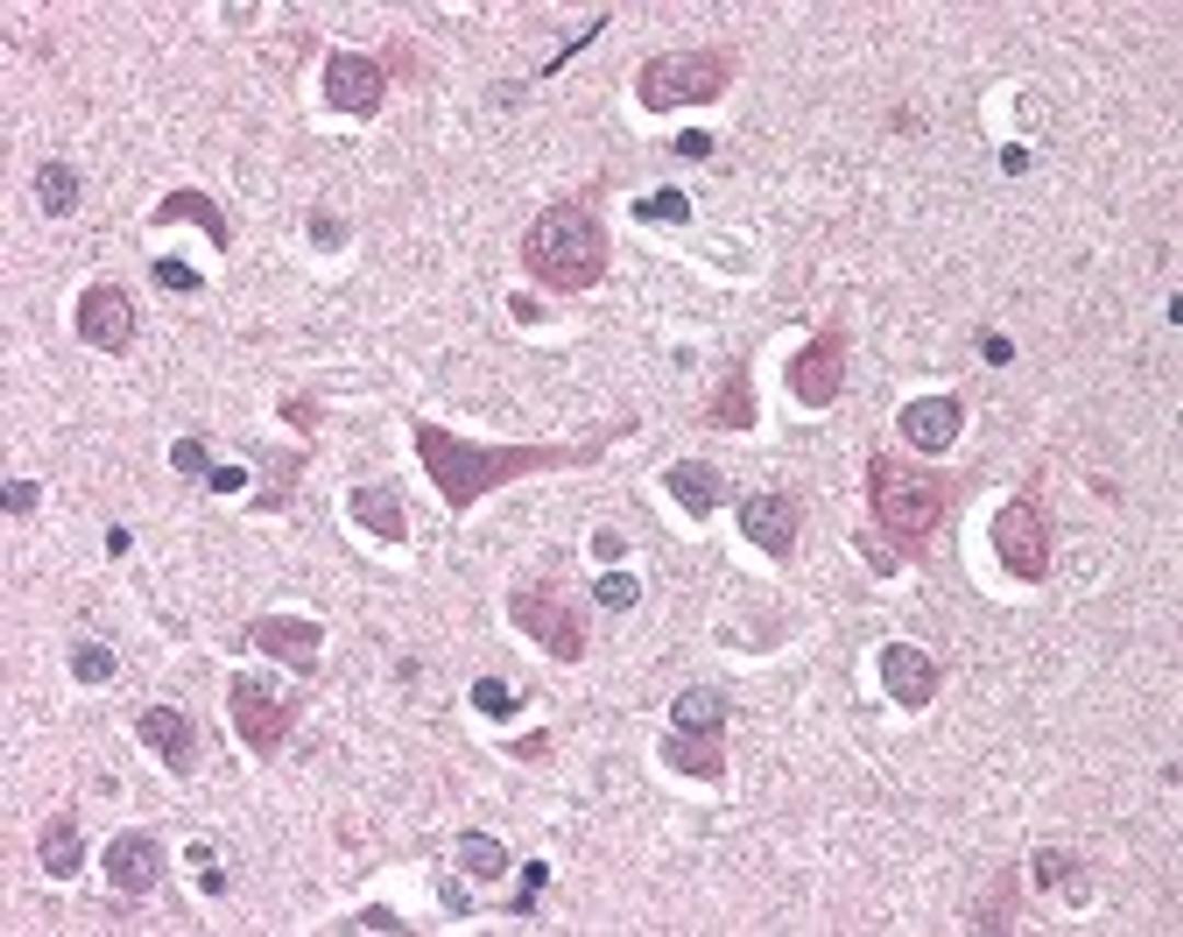 Immunohistochemistry staining of RFFL in brain cortex tissue using RFFL Antibody.