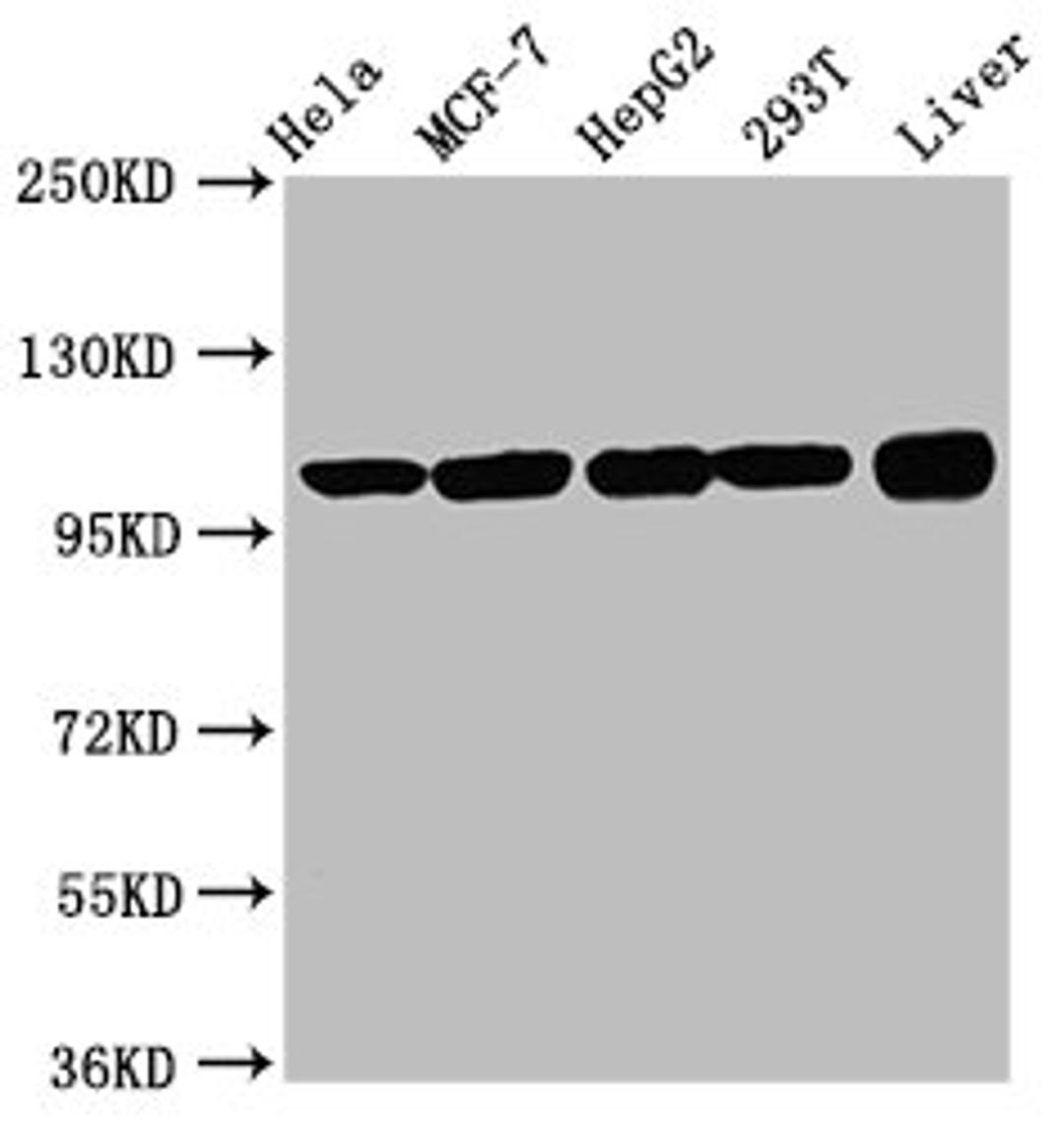 Western Blot. Positive WB detected in: Hela whole cell lysate, MCF-7 whole cell lysate, HepG2 whole cell lysate, 293T whole cell lysate, Rat liver tissue. All lanes: ACTN4 antibody at 3.3µg/ml. Secondary. Goat polyclonal to rabbit IgG at 1/50000 dilution. Predicted band size: 105, 80, 60 kDa. Observed band size: 105 kDa