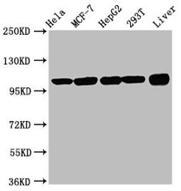 Western Blot. Positive WB detected in: Hela whole cell lysate, MCF-7 whole cell lysate, HepG2 whole cell lysate, 293T whole cell lysate, Rat liver tissue. All lanes: ACTN4 antibody at 3.3µg/ml. Secondary. Goat polyclonal to rabbit IgG at 1/50000 dilution. Predicted band size: 105, 80, 60 kDa. Observed band size: 105 kDa