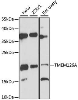 Western blot - TMEM126A antibody (A12823)