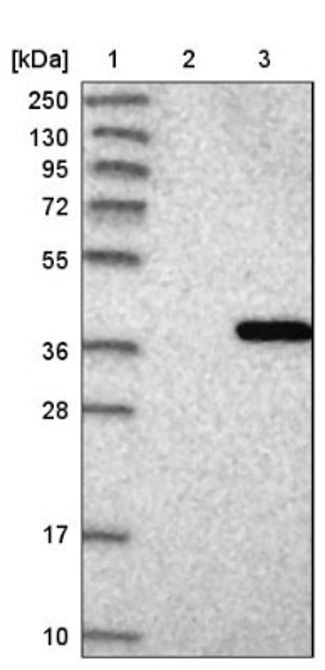 Western Blot: MED4 Antibody [NBP1-84977] - Lane 1: Marker [kDa] 250, 130, 95, 72, 55, 36, 28, 17, 10<br/>Lane 2: Negative control (vector only transfected HEK293T lysate)<br/>Lane 3: Over-expression lysate (Co-expressed with a C-terminal myc-DDK tag (~3.1 kDa) in mammalian HEK293T cells, LY415456)