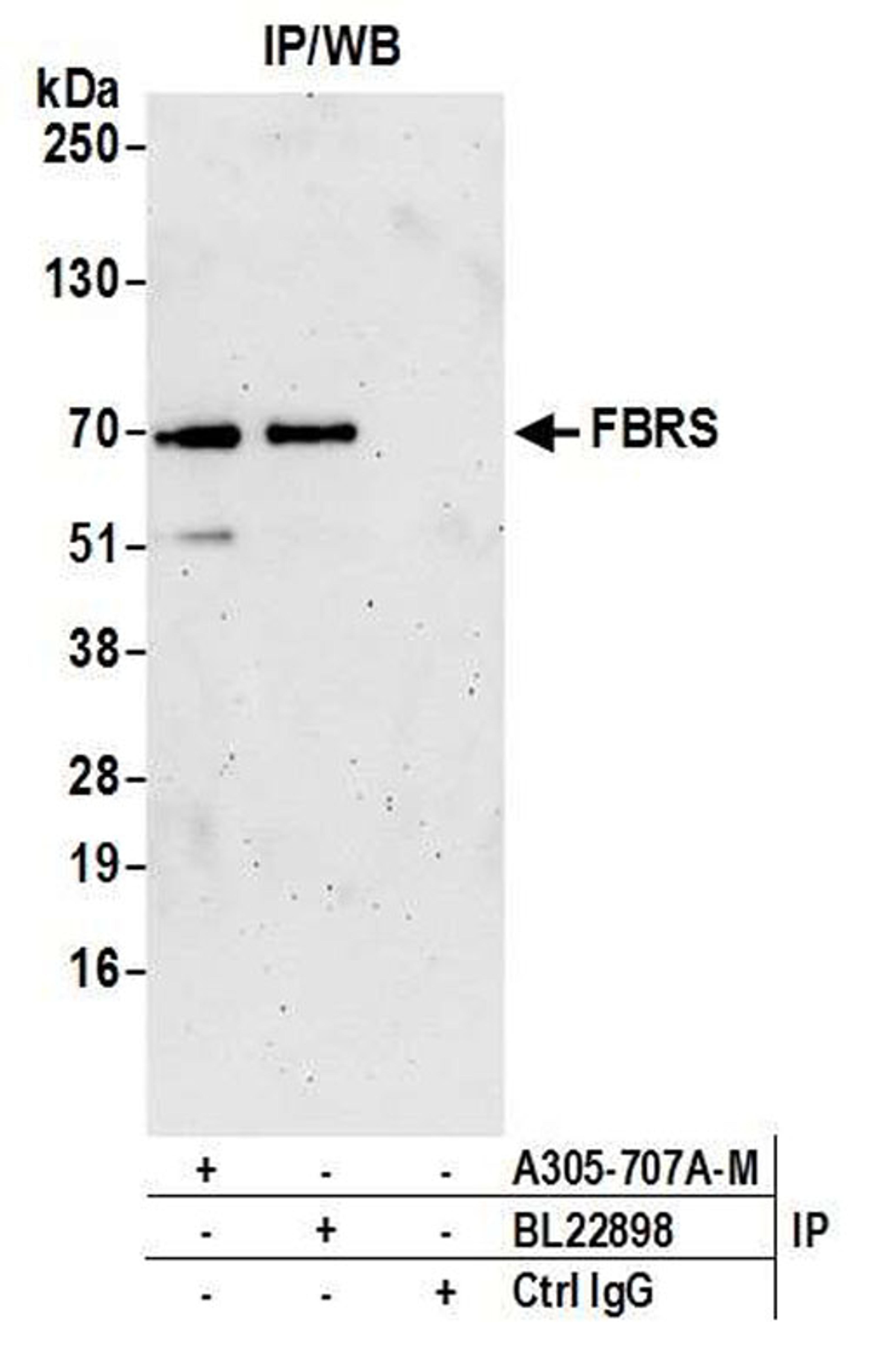 Detection of human FBRS by WB of IP.