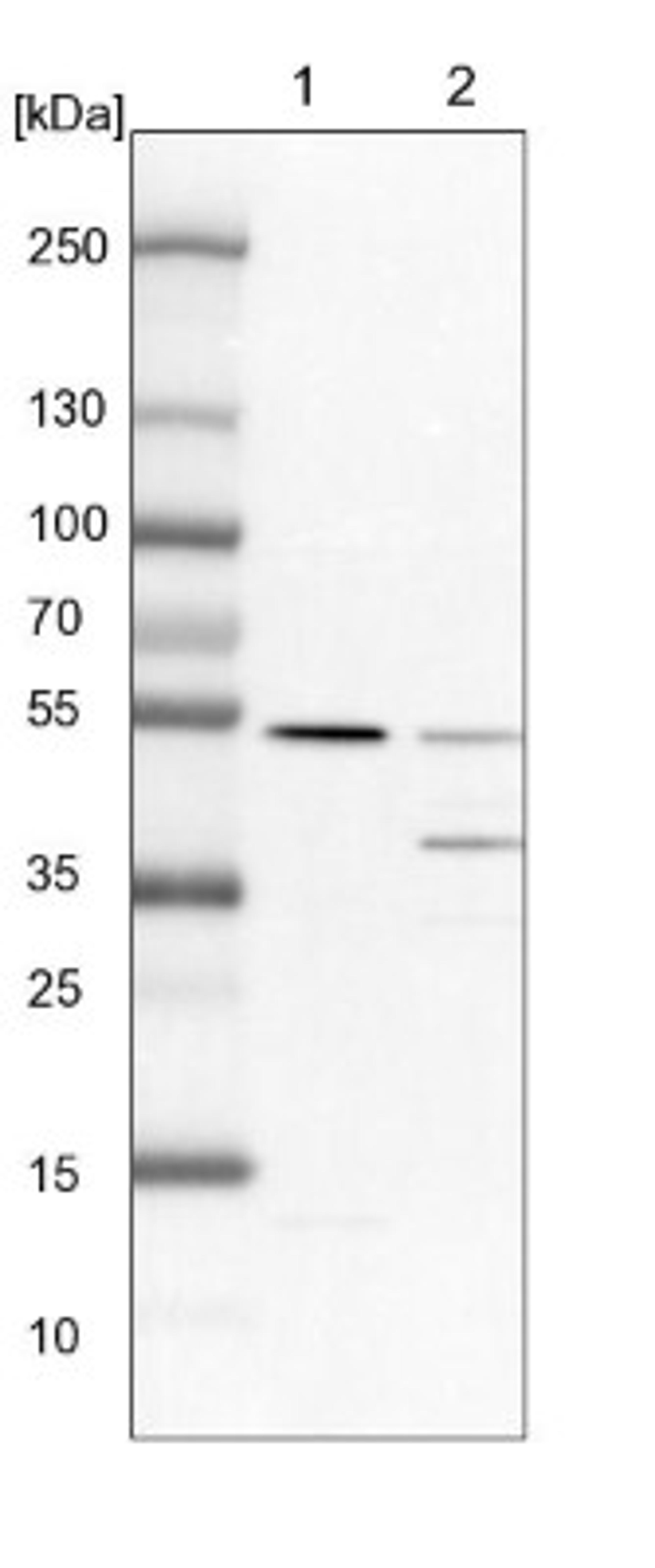 Western Blot: TADA3L Antibody [NBP1-90243] - Lane 1: NIH-3T3 cell lysate (Mouse embryonic fibroblast cells)<br/>Lane 2: NBT-II cell lysate (Rat Wistar bladder tumour cells)