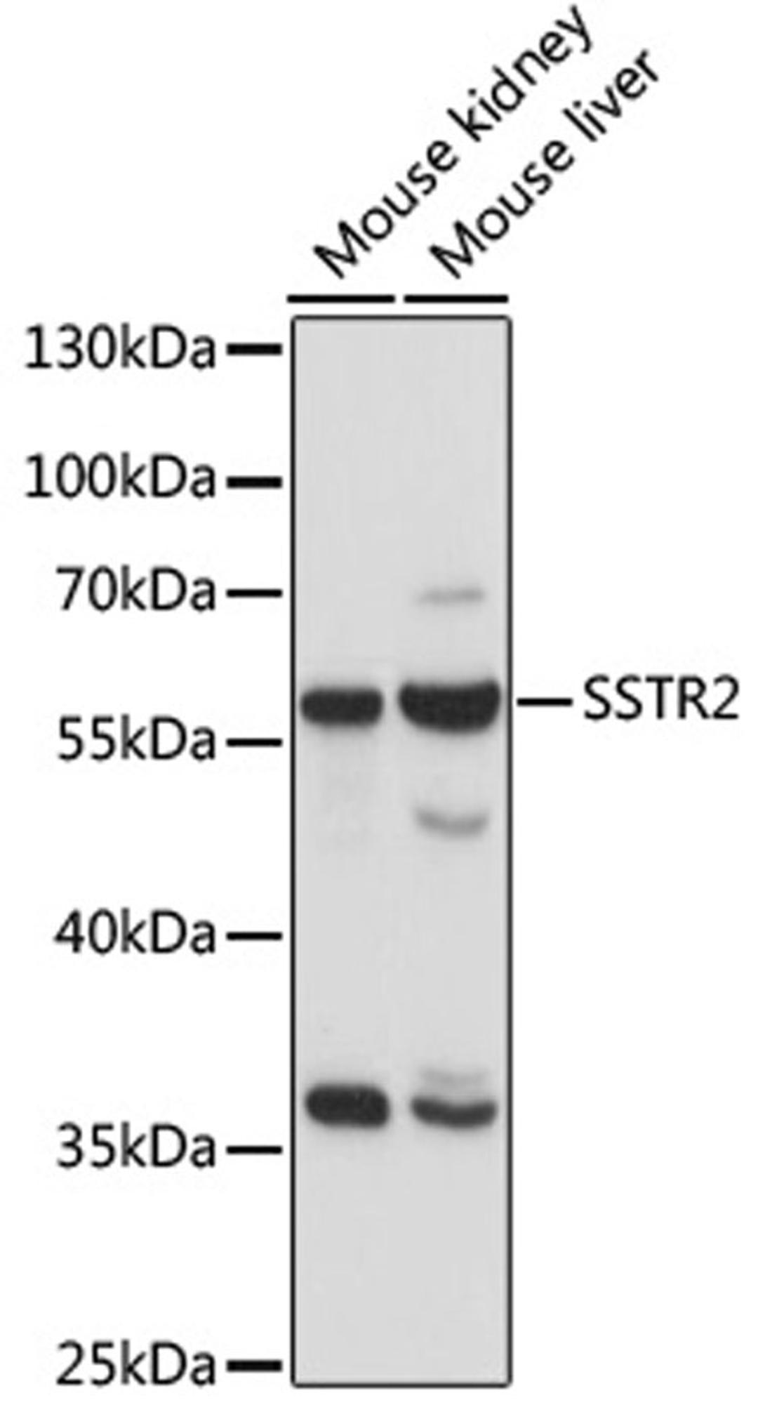 Western blot - SSTR2 antibody (A15101)