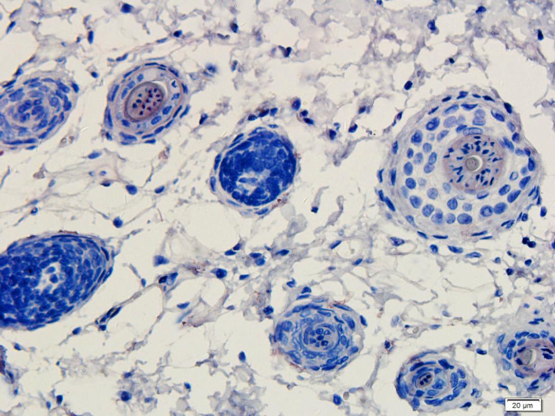 IHC-P image of rat skin tissue using anti-ATAD2 (dilution of primary antibody at 1:500)