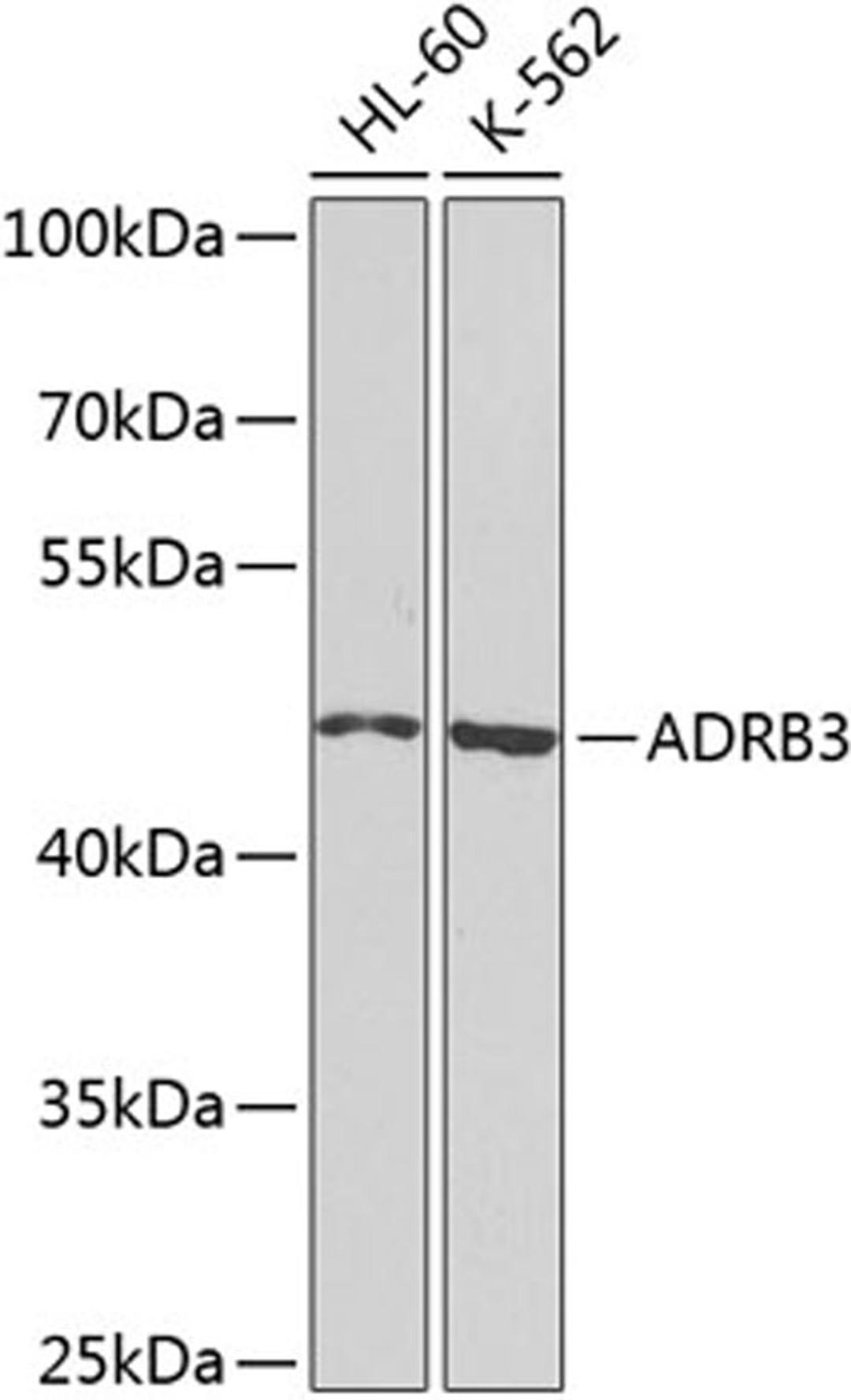 Western blot - ADRB3 antibody (A8607)