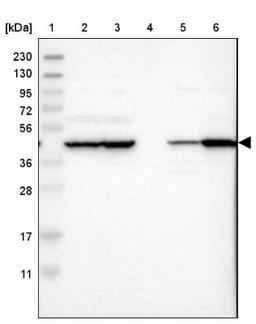 Western Blot: PHACS Antibody [NBP1-90260] - Lane 1: Marker [kDa] 230, 130, 95, 72, 56, 36, 28, 17, 11<br/>Lane 2: Human cell line RT-4<br/>Lane 3: Human cell line U-251MG sp<br/>Lane 4: Human plasma (IgG/HSA depleted)<br/>Lane 5: Human liver tissue<br/>Lane 6: Human tonsil tissue