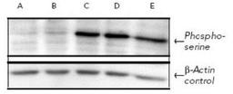 Western Blot: Phosphoserine Antibody [NB100-1953] - Analysis using the HRP conjugate of NB100-1953. Detection of human MMRU melanoma cells probed with Phosphoserine polyclonal antibody. Top (from the left): MMRU cells treated with 0 (A), 50 (B), 200 (C), 400 (D) l long wavelength UV, or 0.1uM of okadaic acid (E) Bottom: Same samples, except probed with b-actin antibody.