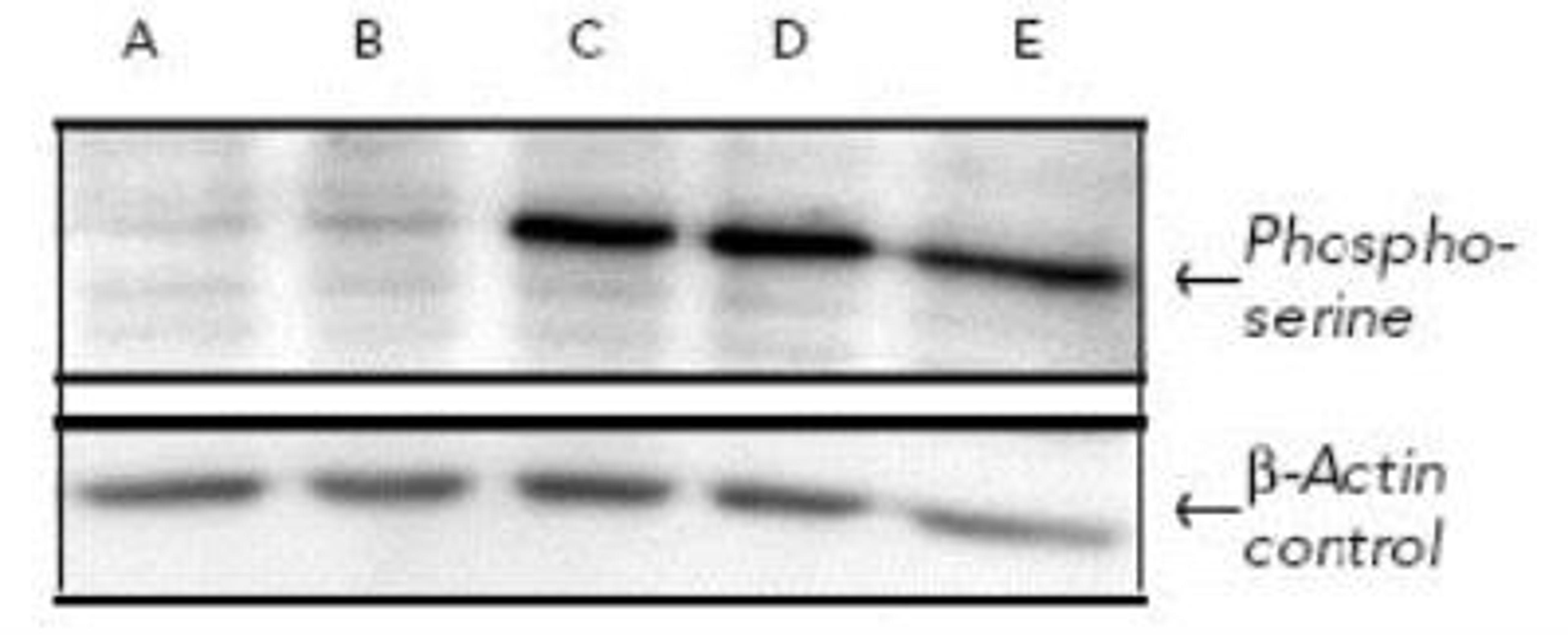 Western Blot: Phosphoserine Antibody [NB100-1953] - Analysis using the HRP conjugate of NB100-1953. Detection of human MMRU melanoma cells probed with Phosphoserine polyclonal antibody. Top (from the left): MMRU cells treated with 0 (A), 50 (B), 200 (C), 400 (D) l long wavelength UV, or 0.1uM of okadaic acid (E) Bottom: Same samples, except probed with b-actin antibody.